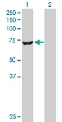 Western Blot: CROT Antibody [H00054677-D01P] - Analysis of CROT expression in transfected 293T cell line by CROT polyclonal antibody.Lane 1: CROT transfected lysate(70.20 KDa).Lane 2: Non-transfected lysate.