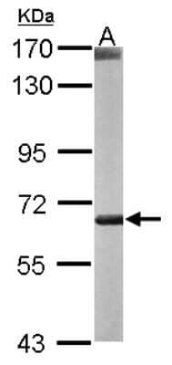 Western Blot: CROT Antibody [NBP1-31441] - Sample (50 ug of whole cell lysate) A: mouse liver 7. 5% SDS PAGE; antibody diluted at 1:1000.