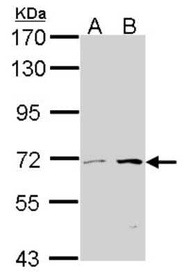 Western Blot: CROT Antibody [NBP1-31441] - Sample (30 ug of whole cell lysate) A: 293T B: A431 7. 5% SDS PAGE COT antibody, antibody diluted at 1:1000.