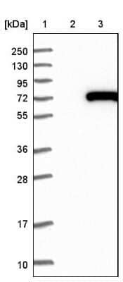 Western Blot: CROT Antibody [NBP1-85502] - Lane 1: Marker [kDa] 250, 130, 95, 72, 55, 36, 28, 17, 10. Lane 2: Negative control (vector only transfected HEK293T lysate). Lane 3: Over-expression lysate (Co-expressed with a C-terminal myc-DDK tag (3.1 kDa) in mammalian HEK293T cells).