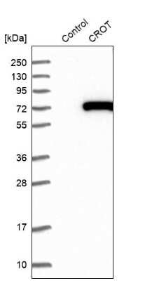 Western Blot: CROT Antibody [NBP1-85502] - Analysis in control (vector only transfected HEK293T lysate) and CROT over-expression lysate (Co-expressed with a C-terminal myc-DDK tag (3.1 kDa) in mammalian HEK293T cells).