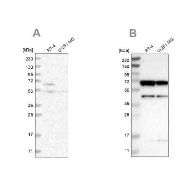 <b>Independent Antibodies Validation. </b>Western Blot: CROT Antibody [NBP1-85502] - Analysis using Anti-CROT antibody NBP1-85502 (A) shows similar pattern to independent antibody NBP1-85501 (B).