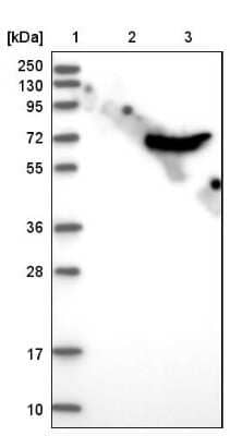 Western Blot: CROT Antibody [NBP1-85503] - Lane 1: Marker [kDa] 250, 130, 95, 72, 55, 36, 28, 17, 10. Lane 2: Negative control (vector only transfected HEK293T lysate). Lane 3: Over-expression lysate (Co-expressed with a C-terminal myc-DDK tag (3.1 kDa) in mammalian HEK293T cells).