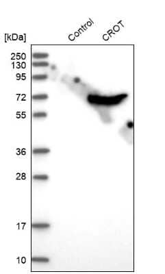 Western Blot: CROT Antibody [NBP1-85503] - Analysis in control (vector only transfected HEK293T lysate) and CROT over-expression lysate (Co-expressed with a C-terminal myc-DDK tag (3.1 kDa) in mammalian HEK293T cells).