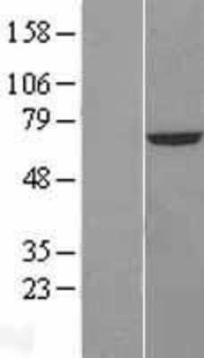 Western Blot: CROT Overexpression Lysate (Adult Normal) [NBL1-09489] Left-Empty vector transfected control cell lysate (HEK293 cell lysate); Right -Over-expression Lysate for CROT.