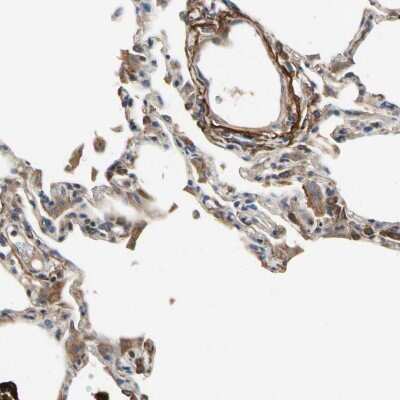 Immunohistochemistry-Paraffin: CRTAC1 Antibody [NBP1-88864] - Staining of human lung shows high expression.