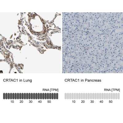 Immunohistochemistry-Paraffin: CRTAC1 Antibody [NBP1-88864] - Staining in human lung and pancreas tissues using anti-CRTAC1 antibody. Corresponding CRTAC1 RNA-seq data are presented for the same tissues.