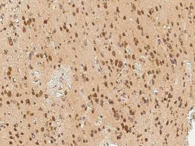 Immunohistochemistry-Paraffin: CRTAC1 Antibody [NBP2-98935] - Immunochemical staining of human CRTAC1 in human brain with rabbit polyclonal antibody (1:200, formalin-fixed paraffin embedded sections).