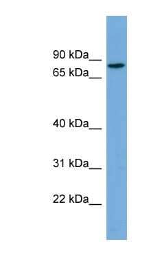 Western Blot: CRTAC1 Antibody [NBP1-57722] - HepG2 cell lysate, concentration 0.2-1 ug/ml.
