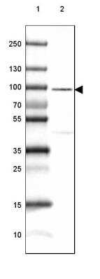 <b>Orthogonal Strategies Validation. </b>Western Blot: CRTAC1 Antibody [NBP1-88864] - Lane 1: Marker  [kDa] 230, 130, 95, 72, 56, 36, 28, 17, 11.  Lane 2: Human lung tissue.