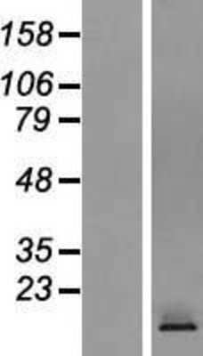 Western Blot: CRTAM Overexpression Lysate (Adult Normal) [NBP2-06714] Left-Empty vector transfected control cell lysate (HEK293 cell lysate); Right -Over-expression Lysate for CRTAM.