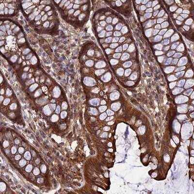 Immunohistochemistry-Paraffin: CRTAP Antibody [NBP1-94104] - Staining of human colon shows strong cytoplasmic and membranous positivity in glandular cells.