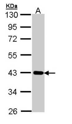 Western Blot: CRTAP Antibody [NBP1-32884] - Sample (30 ug of whole cell lysate) A: A431 10% SDS PAGE; antibody diluted at 1:1000.