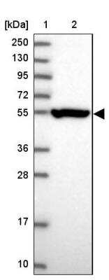 Western Blot: CRTAP Antibody [NBP1-94104] - Lane 1: Marker  [kDa] 250, 130, 95, 72, 55, 36, 28, 17, 10.  Lane 2: Human cell line RT-4