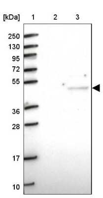 Western Blot: CRTAP Antibody [NBP1-94105] - Lane 1: Marker  [kDa] 250, 130, 95, 72, 55, 36, 28, 17, 10.  Lane 2: Human cell line RT-4.  Lane 3: Human cell line U-251MG sp