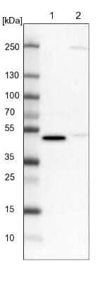 Western Blot: CRTAP Antibody [NBP1-94105] - Lane 1: NIH-3T3 cell lysate (Mouse embryonic fibroblast cells)Lane 2: NBT-II cell lysate (Rat Wistar bladder tumour cells)