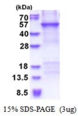 SDS-Page: CRTAP Recombinant Protein [NBP2-51563] - 15% SDS Page (3 ug)