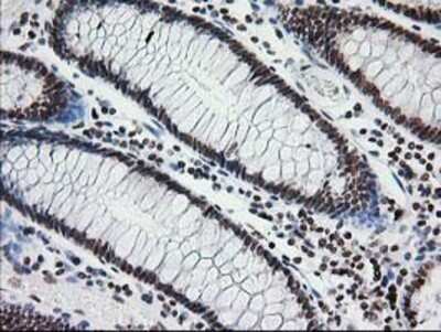 Immunohistochemistry: CRY2 Antibody (OTI1H5) - Azide and BSA Free [NBP2-70449] - Staining of paraffin-embedded Human colon tissue using anti-CRY2 mouse monoclonal antibody.