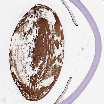 Immunohistochemistry-Paraffin: CRYBA4 Antibody [NBP2-57040] - Staining of eye shows strong positivity in the lens.