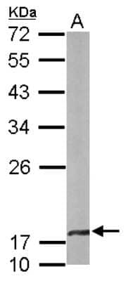 Western Blot: CRYBA4 Antibody [NBP1-32741] - Sample (50 ug of whole cell lysate) A: mouse brain 12% SDS PAGE; antibody diluted at 1:1000.