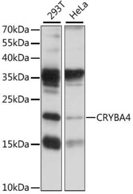 Western Blot: CRYBA4 Antibody [NBP2-92223] - Analysis of extracts of various cell lines, using CRYBA4 at 1:1000 dilution.Secondary antibody: HRP Goat Anti-Rabbit IgG (H+L) at 1:10000 dilution.Lysates/proteins: 25ug per lane.Blocking buffer: 3% nonfat dry milk in TBST.Detection: ECL Basic Kit .Exposure time: 30S.