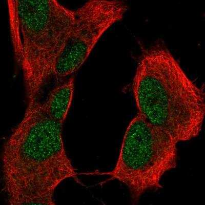 Immunocytochemistry/ Immunofluorescence CRYBB2 Antibody