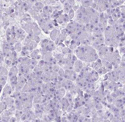 Immunohistochemistry-Paraffin: CRYBB2 Antibody [NBP2-13876] - Staining of human pancreas shows on positivity in exorcirne glanuldar cells as expected.