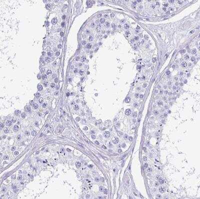 Immunohistochemistry-Paraffin: CRYBB2 Antibody [NBP2-13876] - Staining of human testis shows no positivity in cells in seminiferous ducts as expected.