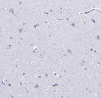 Immunohistochemistry-Paraffin: CRYBB2 Antibody [NBP2-13876] - Staining of human cerebral cortex shows no positivity in neurons as expected.