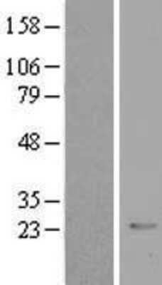 Western Blot: CRYBB2 Overexpression Lysate (Adult Normal) [NBL1-09500] Left-Empty vector transfected control cell lysate (HEK293 cell lysate); Right -Over-expression Lysate for CRYBB2.