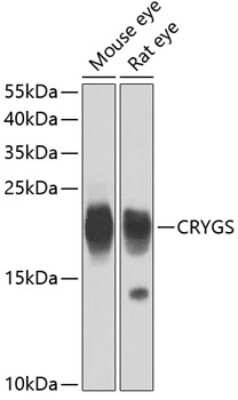 Western Blot: CRYGS Antibody [NBP2-92525] - Analysis of extracts of various cell lines, using CRYGS at 1:4000 dilution.Secondary antibody: HRP Goat Anti-Rabbit IgG (H+L) at 1:10000 dilution.Lysates/proteins: 25ug per lane.Blocking buffer: 3% nonfat dry milk in TBST.Detection: ECL Basic Kit .Exposure time: 1s.