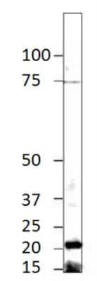 Western Blot: CRYGS Antibody [NBP3-12221] - WB of NBP3-12221 ith 1:750 antibody ailution in DiluObuffer. Apparent MW is 21 kDa.