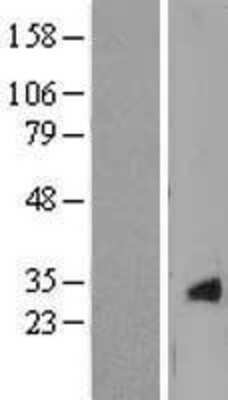 Western Blot: CRYGS Overexpression Lysate (Adult Normal) [NBL1-09502] Left-Empty vector transfected control cell lysate (HEK293 cell lysate); Right -Over-expression Lysate for CRYGS.