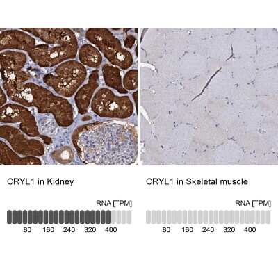 Immunohistochemistry-Paraffin: CRYL1 Antibody [NBP1-93718] - Staining in human kidney and skeletal muscle tissues using anti-CRYL1 antibody. Corresponding CRYL1 RNA-seq data are presented for the same tissues.