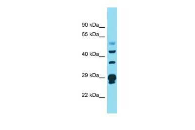 Western Blot: CRYL1 Antibody [NBP2-82773] - Host: Rabbit. Target Name: CRYL1. Sample Type: Ovary Tumor lysates. Antibody Dilution: 1.0ug/ml