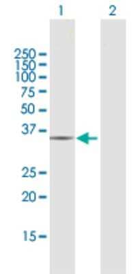 Western Blot: CRYZ Antibody [H00001429-D01P] - Analysis of CRYZ expression in transfected 293T cell line by CRYZ polyclonal antibody.Lane 1: CRYZ transfected lysate(35.20 KDa).Lane 2: Non-transfected lysate.