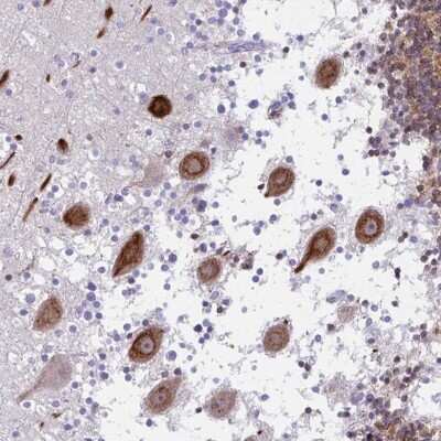 Immunohistochemistry: CSAP Antibody [NBP2-33394] - Staining of human cerebellum shows strong cytoplasmic positivity in Purkinje cells.