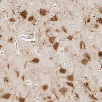 Immunohistochemistry-Paraffin: CSAP Antibody [NBP1-83446] - Staining of human cerebral cortex shows high expression.
