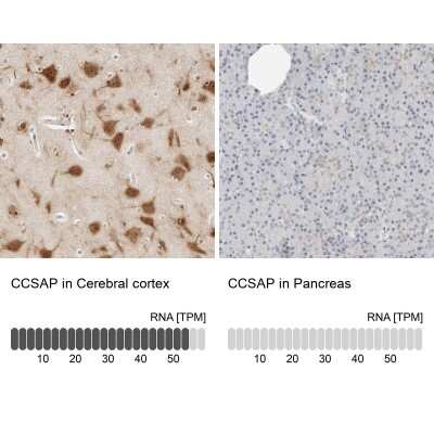 <b>Orthogonal Strategies Validation. </b>Immunohistochemistry-Paraffin: CSAP Antibody [NBP1-83446] - Staining in human cerebral cortex and pancreas tissues using anti-CCSAP antibody. Corresponding CCSAP RNA-seq data are presented for the same tissues.