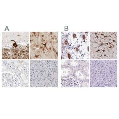 <b>Independent Antibodies Validation. </b>Immunohistochemistry-Paraffin: CSAP Antibody [NBP1-83446] - Staining of human cerebellum, cerebral cortex, kidney and pancreas using Anti-CCSAP antibody NBP1-83446 (A) shows similar protein distribution across tissues to independent antibody NBP2-33394 (B).