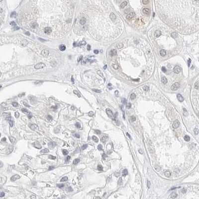 Immunohistochemistry-Paraffin: CSAP Antibody [NBP1-83446] - Staining of human kidney.