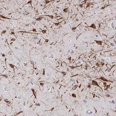Immunohistochemistry-Paraffin: CSAP Antibody [NBP2-33394] - Staining of human cerebral cortex shows high expression.