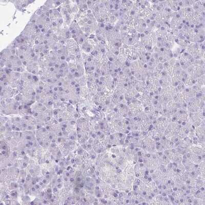 Immunohistochemistry-Paraffin: CSAP Antibody [NBP2-33394] - Staining of human pancreas shows low expression as expected.