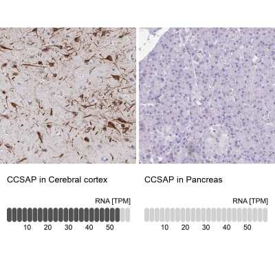 <b>Orthogonal Strategies Validation. </b>Immunohistochemistry-Paraffin: CSAP Antibody [NBP2-33394] - Staining in human cerebral cortex and pancreas tissues using anti-CCSAP antibody. Corresponding CCSAP RNA-seq data are presented for the same tissues.