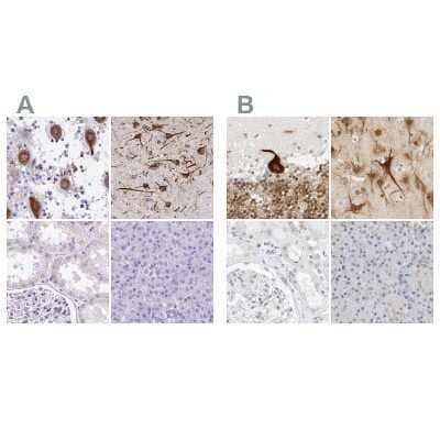 <b>Independent Antibodies Validation. </b>Immunohistochemistry-Paraffin: CSAP Antibody [NBP2-33394] - Staining of human cerebellum, cerebral cortex, kidney and pancreas using Anti-CCSAP antibody NBP2-33394 (A) shows similar protein distribution across tissues to independent antibody NBP1-83446 (B).