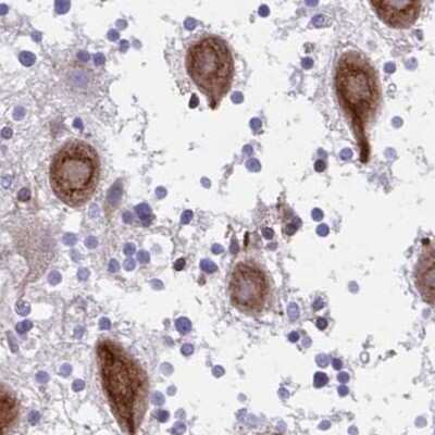 Immunohistochemistry-Paraffin: CSAP Antibody [NBP2-33394] - Staining of human cerebellum.