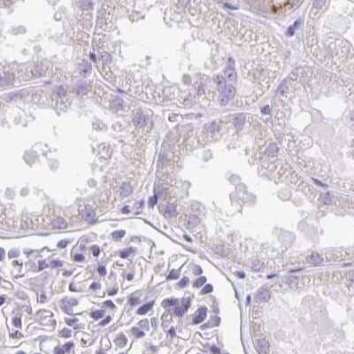 Immunohistochemistry-Paraffin: CSAP Antibody [NBP2-33394] - Staining of human kidney.