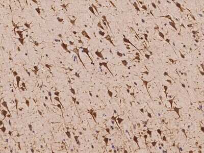 Immunohistochemistry-Paraffin: CSAP Antibody [NBP2-98036] - Immunochemical staining of human CSAP in human brain with rabbit polyclonal antibody at 1:300 dilution, formalin-fixed paraffin embedded sections.