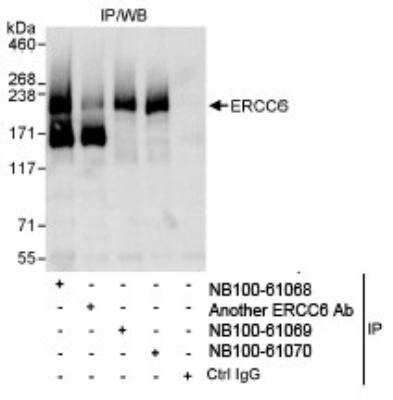 Immunoprecipitation: CSB Antibody [NB100-61070] - Detection of Human ERCC6 on HeLa whole cell lysate using NB100-61070. ERCC6 was also immunoprecipitated by another rabbit anti-ERCC6 antibody NB100-61068 and NB100-61069.