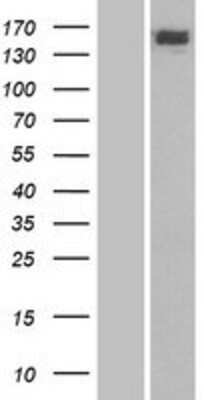 Western Blot: CSB Overexpression Lysate (Adult Normal) [NBP2-11176] Left-Empty vector transfected control cell lysate (HEK293 cell lysate); Right -Over-expression Lysate for CSB.